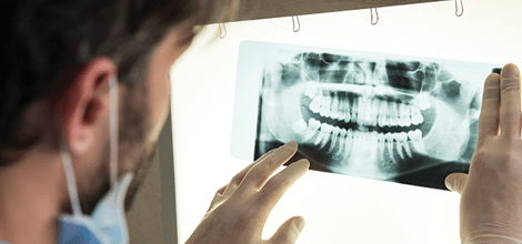 Erroneous extraction